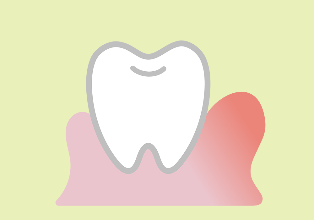 歯茎が腫れた歯