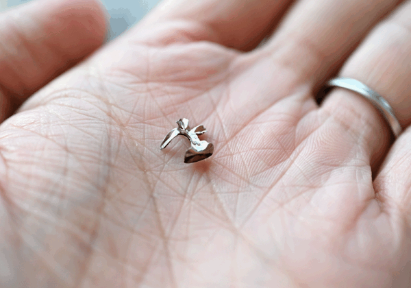 とれてしまったかぶせ物